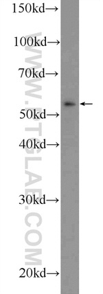 RNFT2 Antibody in Western Blot (WB)