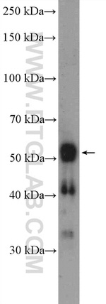 RNFT2 Antibody in Western Blot (WB)