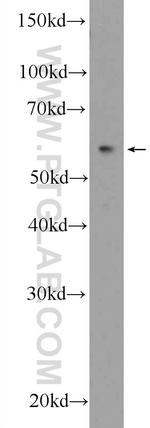 RNFT2 Antibody in Western Blot (WB)