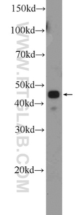 API5 Antibody in Western Blot (WB)