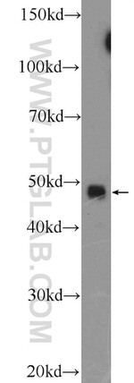 API5 Antibody in Western Blot (WB)