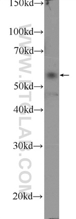 API5 Antibody in Western Blot (WB)