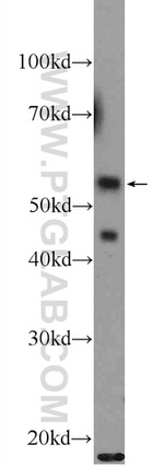API5 Antibody in Western Blot (WB)