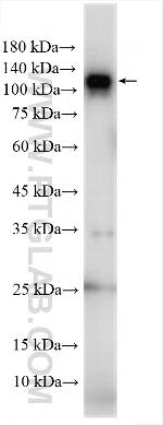 DPYD Antibody in Western Blot (WB)