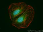 MYO18B Antibody in Immunocytochemistry (ICC/IF)