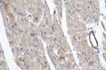 MYO18B Antibody in Immunohistochemistry (Paraffin) (IHC (P))
