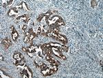 BAIAP2L1 Antibody in Immunohistochemistry (Paraffin) (IHC (P))