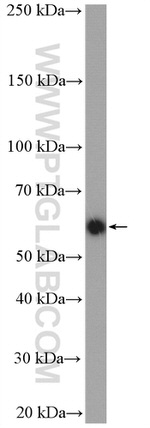 BAIAP2L1 Antibody in Western Blot (WB)