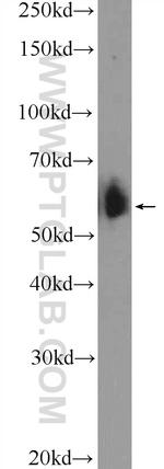 BAIAP2L1 Antibody in Western Blot (WB)
