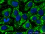 ATAD4/PRR15L Antibody in Immunocytochemistry (ICC/IF)