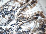 OSGEPL1 Antibody in Immunohistochemistry (Paraffin) (IHC (P))