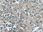 TACC3 Antibody in Immunohistochemistry (Paraffin) (IHC (P))