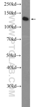TACC3 Antibody in Western Blot (WB)