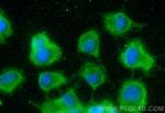 BDNF Antibody in Immunocytochemistry (ICC/IF)