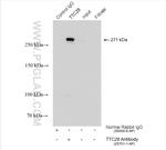 TTC28 Antibody in Immunoprecipitation (IP)