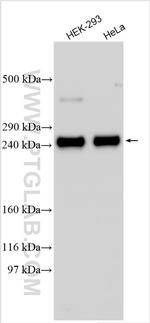 TTC28 Antibody in Western Blot (WB)