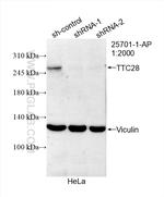TTC28 Antibody in Western Blot (WB)