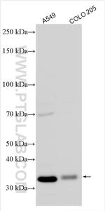CDKL1 Antibody in Western Blot (WB)