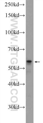 GDPD5 Antibody in Western Blot (WB)