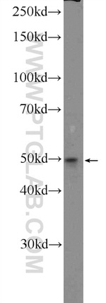 GDPD5 Antibody in Western Blot (WB)