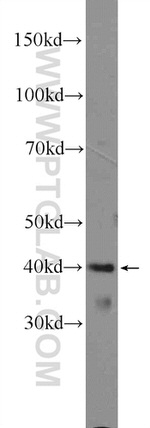ARMCX3 Antibody in Western Blot (WB)