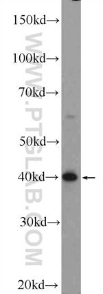 ARMCX3 Antibody in Western Blot (WB)