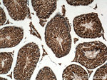 CXorf61 Antibody in Immunohistochemistry (Paraffin) (IHC (P))