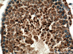 CXorf61 Antibody in Immunohistochemistry (Paraffin) (IHC (P))