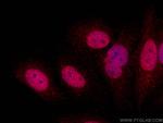 UHRF2 Antibody in Immunocytochemistry (ICC/IF)