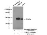 UHRF2 Antibody in Immunoprecipitation (IP)