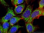 CHCHD5 Antibody in Immunocytochemistry (ICC/IF)