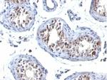 HGAL (Human Germinal Center Associated Lymphoma Marker) Monoclonal Antibody (HGAL/830)