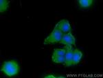 MAP6/STOP Antibody in Immunocytochemistry (ICC/IF)