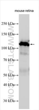 MAP6/STOP Antibody in Western Blot (WB)