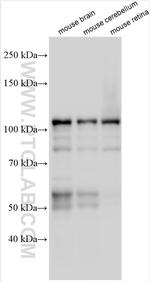 MAP6/STOP Antibody in Western Blot (WB)