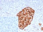 GAD2/GAD65 (GABAergic Neuronal Marker) Recombinant Rabbit Monoclonal Antibody (rGAD2/9382)