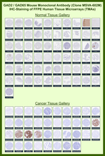 GAD2/GAD65 (GABAergic Neuronal Marker) Monoclonal Antibody (MSVA-602M)