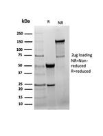 GAD2/GAD65 (GABAergic Neuronal Marker) Recombinant Rabbit Monoclonal Antibody (GAD2/6488R)
