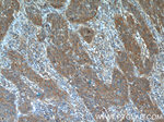 BLOC1S3 Antibody in Immunohistochemistry (Paraffin) (IHC (P))