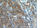 BLOC1S3 Antibody in Immunohistochemistry (Paraffin) (IHC (P))