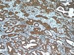BLOC1S3 Antibody in Immunohistochemistry (Paraffin) (IHC (P))