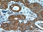 BLOC1S3 Antibody in Immunohistochemistry (Paraffin) (IHC (P))
