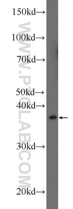 AGPAT3 Antibody in Western Blot (WB)
