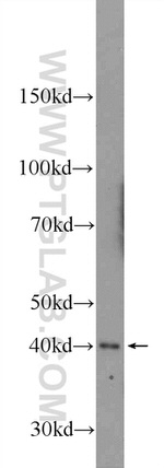 AGPAT3 Antibody in Western Blot (WB)