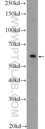 ZNF419 Antibody in Western Blot (WB)