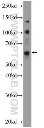 ZNF419 Antibody in Western Blot (WB)