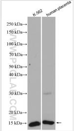 HBG1 Antibody in Western Blot (WB)