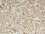 CERK Antibody in Immunohistochemistry (Paraffin) (IHC (P))