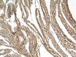 CERK Antibody in Immunohistochemistry (Paraffin) (IHC (P))
