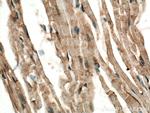 CERK Antibody in Immunohistochemistry (Paraffin) (IHC (P))